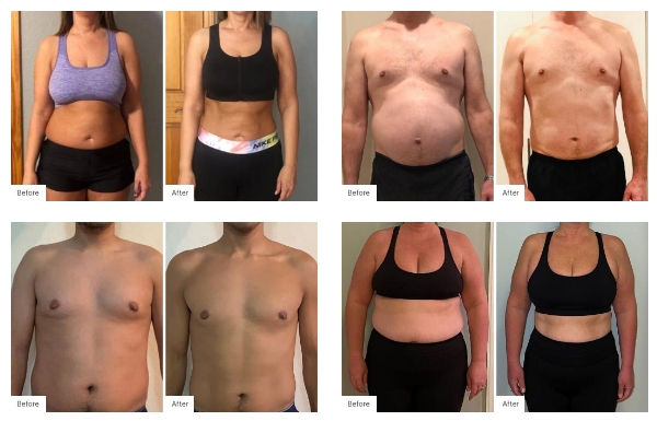 Before and After Real Result images of people that have used the NeoraFit™ Weight Management & Wellness Set.